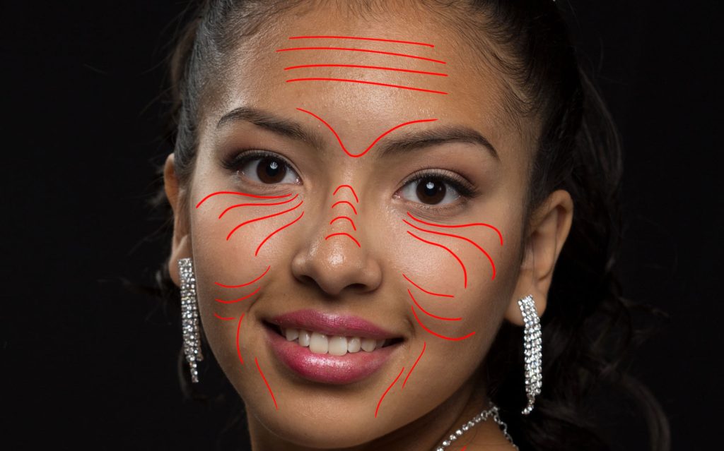 The red lines illustrate the direction that the skin moves.