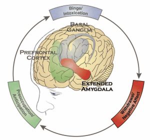 Illustration highlights the extended amygdala region of the brain and the associated withdrawal/negative affect stage of the addiction cycle.