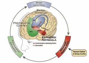 Illustration shows the activation of stress neurotransmitters in the extended amygdala during the withdrawal/negative affect stage of the addition cycle. These stress neurotransmitters include corticotropin-releasing factor (CRF), norepinephrine, and dynorphin.