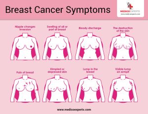 Visual guide to inspection of breasts