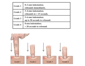 A table showing what grade 1-4 pitting edema is with a visual representation of the size of the indent.