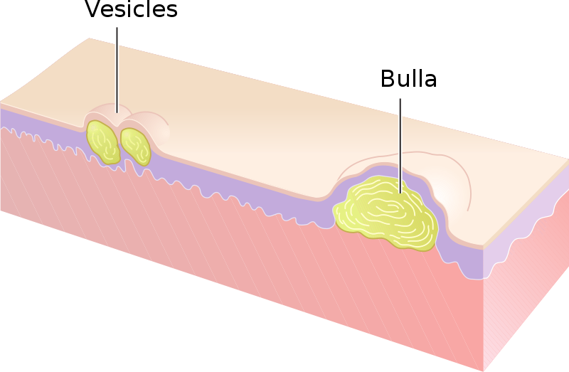 6.7 Skin: Inspection – Nursing Physical Assessment