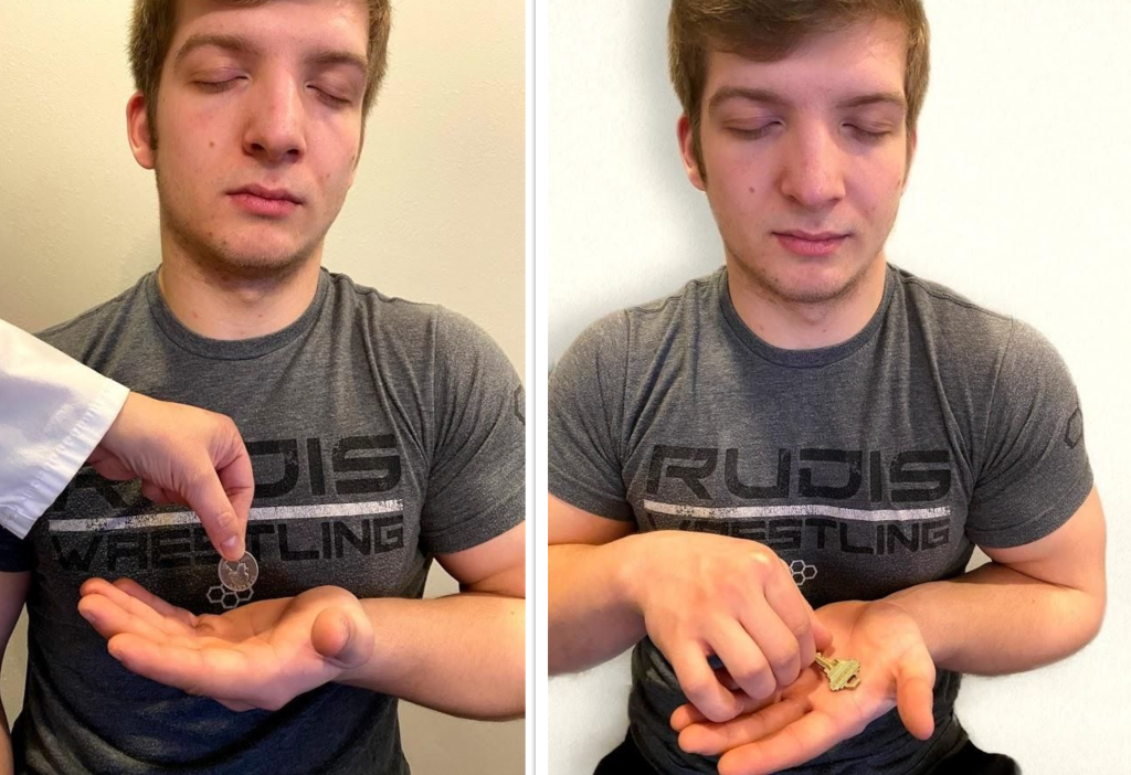 Photo showing male patient demonstrating the stereognosis test with both a coin and a key