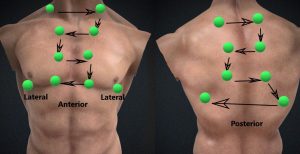 Chest auscultation